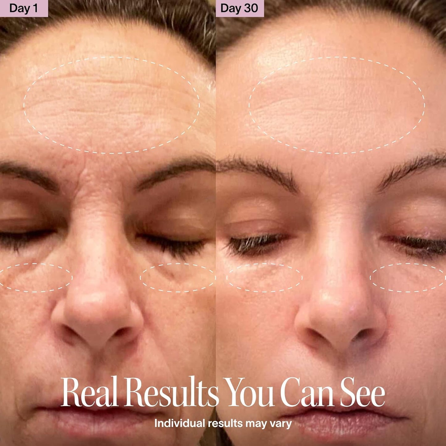 4-in-1 LumaSculpt™ Wand